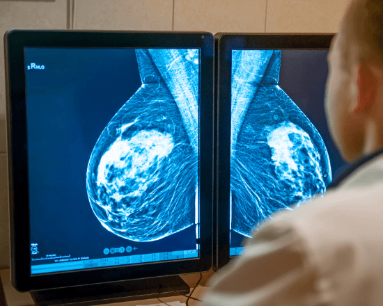 Breast cancer screening
