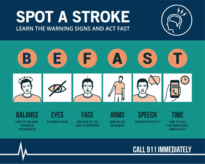 Spot a Stroke.